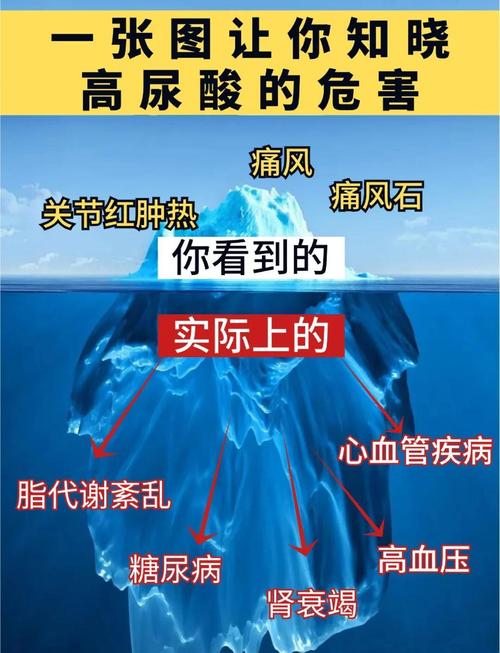 什么是尿酸高及其成因解析 - 健康管理的关键